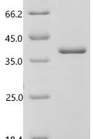 Saccharomyces cerevisiae Glucan 1,3-beta-glucosidase (BGL2) Recombinant Protein - BioCrest Sci