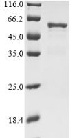 Human Nucleosome assembly protein 1-like 4 (NAP1L4) Recombinant Protein - BioCrest Sci