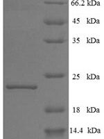 Bovine Interferon tau-1 (IFNT1) Recombinant Protein - BioCrest Sci