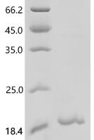 Human AP-3 complex subunit beta-2 (AP3B2), partial Recombinant Protein - BioCrest Sci