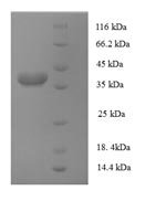 Human AP-1 complex subunit sigma-3 (AP1S3) Recombinant Protein - BioCrest Sci
