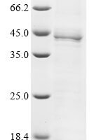 Human Transcription factor Jun (JUN) Recombinant Protein, C-His, aa 1–131 - BioCrest Sci