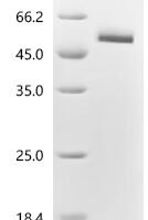 Human R-spondin-2(RSPO2),partial Recombinant Protein - BioCrest Sci