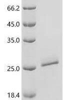 Helicoverpa armigera OBP7 Recombinant Protein - BioCrest Sci