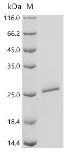 Helicoverpa armigera OBP7 Recombinant Protein, Helicoverpa armigera (Cotton bollworm) (Heliothis armigera), E.coli, C-terminal 6xHis-tagged, 21.1 kDa, purity >≥ 95% as determined by SDS-PAGE.