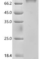 Human Interferon alpha/beta receptor 1 (IFNAR1), partial Recombinant Protein, C-10His - BioCrest Sci