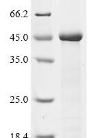 Human Syncytin-1 (ERVW-1), partial Recombinant Protein, N-10His - BioCrest Sci