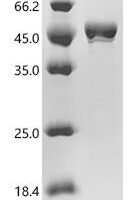 Mouse 3-ketoacyl-CoA thiolase A, peroxisomal (Acaa1a) Recombinant Protein - BioCrest Sci