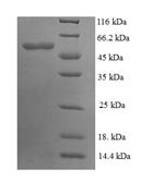 Saccharomyces cerevisiae Pyruvate carboxylase 1 (PYC1), partial Recombinant Protein, N-His, aa 18–470, E.coli - BioCrest Sci
