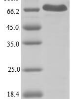 Human NACHT, LRR and PYD domains-containing protein 3 (NLRP3), partial Recombinant Protein, N-His, aa 1–536 - BioCrest Sci