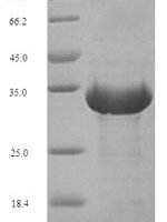 Euroglyphus maynei Mite group 2 allergen Eur m 2 (EURM2) Recombinant Protein, N-His-SUMO - BioCrest Sci