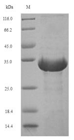 Euroglyphus maynei Mite group 2 allergen Eur m 2 (EURM2) Recombinant Protein, N-His-SUMO, Euroglyphus maynei (Mayne's house dust mite), E.coli, N-terminal 6xHis-SUMO-tagged, 30.1 kDa, purity >≥ 90% as determined by SDS-PAGE.