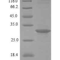 Brucella abortus HTH-type quorum sensing-dependent transcriptional regulator vjbR (vjbR) Recombinant Protein - BioCrest Sci