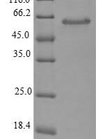 Escherichia coli Glutaminase 1 (glsA1) Recombinant Protein - BioCrest Sci