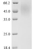 Human herpesvirus 6A Immediate-early protein 1 (U90/U89), partial Recombinant Protein, C-His, aa 665–941, Yeast - BioCrest Sci