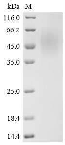 Human herpesvirus 6A Immediate-early protein 1 (U90/U89), partial Recombinant Protein, C-His, aa 665–941, Yeast, Human herpesvirus 6A (strain Uganda-1102) (HHV-6 variant A) (Human B lymphotropic virus), Yeast, C-terminal 6xHis-tagged, 32.9 kDa, purity >≥ 90% as determined by SDS-PAGE.