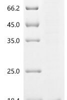 Mus musculus papillomavirus type 1 E4 (E4) Recombinant Protein - BioCrest Sci