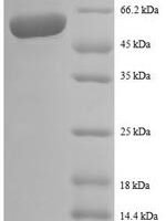 Human Interleukin-12 subunit beta (IL12B) Recombinant Protein, N-GST - BioCrest Sci