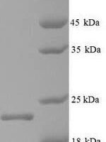 Hepatitis B virus genotype C subtype ayw Capsid protein (C) Recombinant Protein, N-His - BioCrest Sci