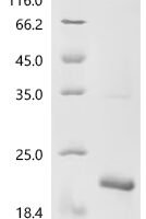 Mycobacterium tuberculosis Metallothionein (mymT) Recombinant Protein, N-His-KSI - BioCrest Sci