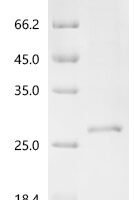 Macaca fascicularis Ubiquitin carboxyl-terminal hydrolase isozyme L1 (UCHL1), partial Recombinant Protein - BioCrest Sci