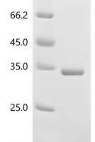 Bordetella pertussis Pertussis toxin subunit 1 (ptxA) (R43K, E163G) Recombinant Protein - BioCrest Sci