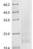 Mouse Interleukin-13 (Il13) Recombinant Protein, C-His - BioCrest Sci
