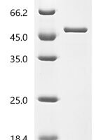 Mouse Adenosine deaminase (Ada) Recombinant Protein - BioCrest Sci