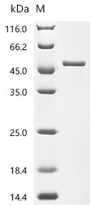 Mouse Adenosine deaminase (Ada) Recombinant Protein, Mus musculus (Mouse), E.coli, C-terminal 6xHis-tagged, 46.8 kDa, purity >≥ 95% as determined by SDS-PAGE.