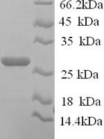 Human Junctional adhesion molecule B (JAM2), partial Recombinant Protein, N-His, aa 29–238, Yeast - BioCrest Sci
