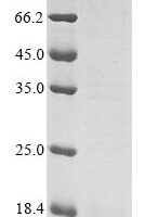 Human coronavirus 229E Spike glycoprotein (S), partial Recombinant Protein, N-10His/C-Myc - BioCrest Sci