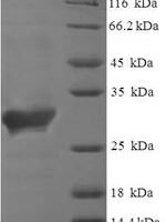 Human Saitohin (STH) Recombinant Protein - BioCrest Sci