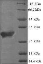 Human Saitohin (STH) Recombinant Protein, Homo sapiens (Human), E.coli, N-terminal 6xHis-SUMO-tagged, 29.7 kDa, purity >≥ 90% as determined by SDS-PAGE.