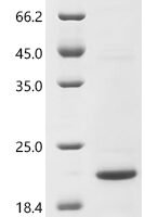 Human CCL5/RANTES Recombinant Protein, C-10His - BioCrest Sci