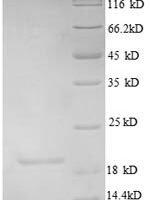 Human Uncharacterized protein C4orf3 (C4orf3), partial Recombinant Protein - BioCrest Sci