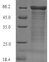 Human Fc receptor-like protein 4 (FCRL4), partial Recombinant Protein, N-His-SUMO - BioCrest Sci