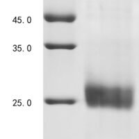 Avian infectious bronchitis virus Spike glycoprotein (S), partial Recombinant Protein, C-His, aa 300–520, strain UK/142/86 - BioCrest Sci