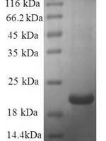 Human Galectin-7 (LGALS7) Recombinant Protein - BioCrest Sci