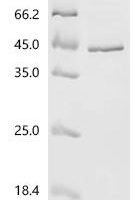 Macaca mulatta Tissue factor pathway inhibitor (TFPI) Recombinant Protein - BioCrest Sci