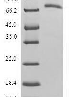 Human Selenide, water dikinase 1 (SEPHS1) Recombinant Protein - BioCrest Sci
