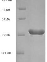 Human papillomavirus type 52 Protein E7 (E7) Recombinant Protein - BioCrest Sci