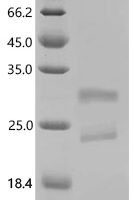 Dog Lipocalin Can f 6.0101 Recombinant Protein, C-His, aa 16–190, Yeast - BioCrest Sci