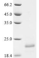 Conus kinoshitai Mu-conotoxin KIIIB, partial Recombinant Protein, N-His-SUMOstar - BioCrest Sci