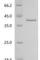 Drosophila melanogaster Copia protein (GIP), partial Recombinant Protein - BioCrest Sci