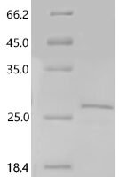 Human MHC class I chain-related molecule B (MICB), partial Recombinant Protein, C-10His, aa 25–198 - BioCrest Sci