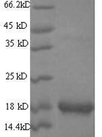 Mouse Group XIIA secretory phospholipase A2 (Pla2g12a) Recombinant Protein - BioCrest Sci