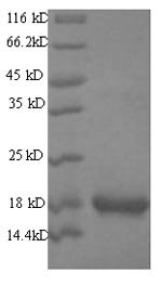 Mouse Group XIIA secretory phospholipase A2 (Pla2g12a) Recombinant Protein, Mus musculus (Mouse), E.coli, N-terminal 6xHis-SUMO-tagged, 34.7 kDa, purity >≥ 90% as determined by SDS-PAGE.