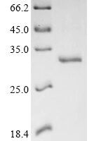White-tufted-ear marmoset Thymic stromal lymphopoietin (TSLP), partial Recombinant Protein - BioCrest Sci