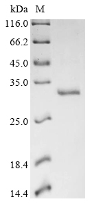 White-tufted-ear marmoset Thymic stromal lymphopoietin (TSLP), partial Recombinant Protein, Callithrix jacchus (White-tufted-ear marmoset), E.coli, N-terminal 6xHis-SUMO-tagged, 28.1 kDa, purity >≥ 90% as determined by SDS-PAGE.