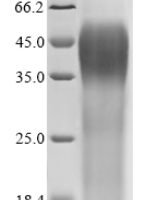 Human Cation channel sperm-associated protein 1 (CATSPER1), partial Recombinant Protein - BioCrest Sci